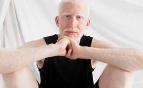 rêver d'homme albinos en islam un rêve de blancheur signification Ibn Sirin